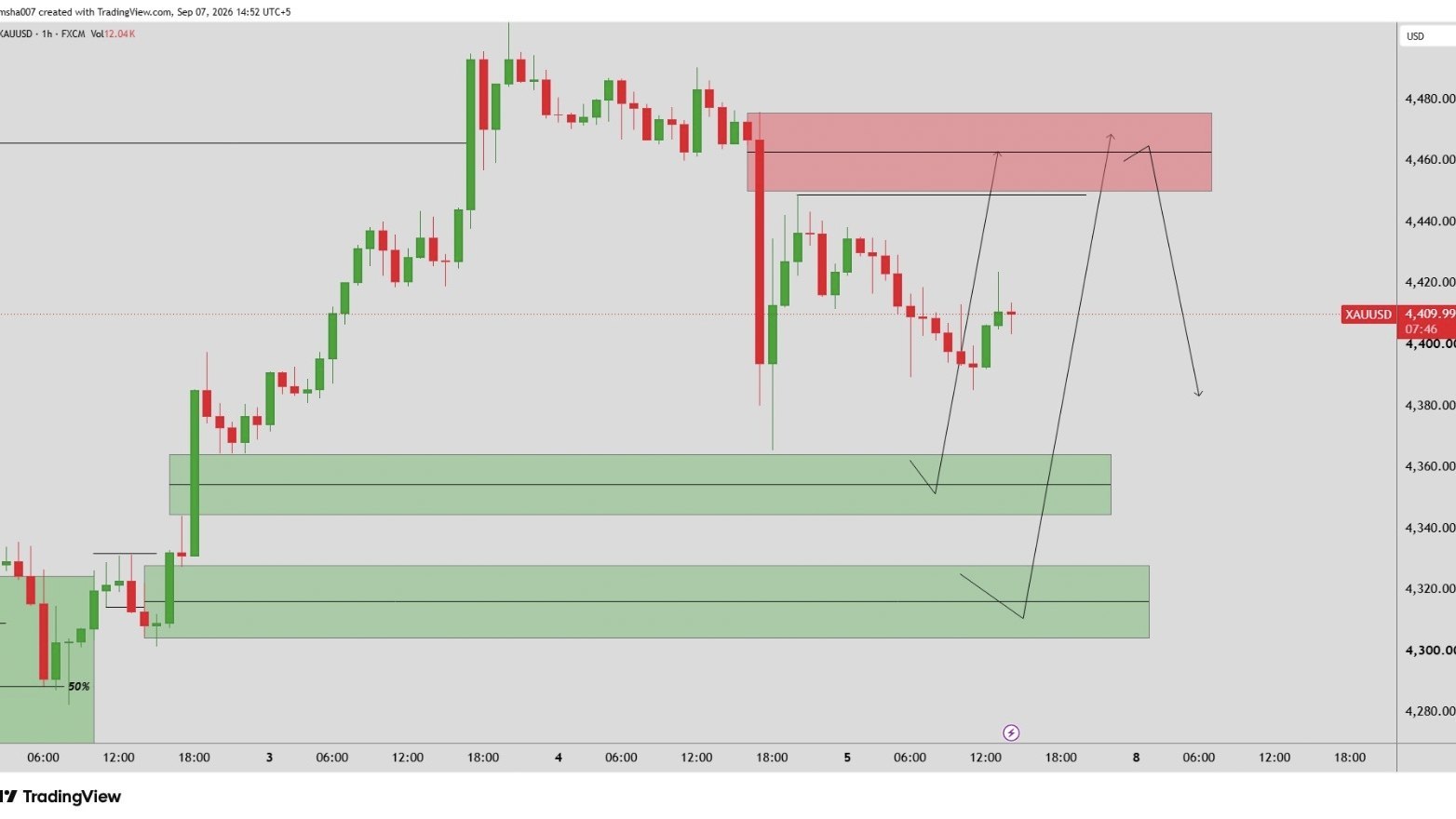 XAUUSD GOLD TRADER